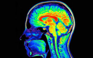 Lee más sobre el artículo ¿Existe deterioro cognitivo asociado al consumo de drogas?