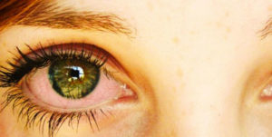 Lee más sobre el artículo Cómo actúa el cannabis en el cerebro?